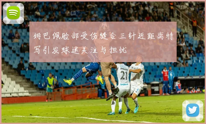 姆巴佩脸部受伤缝合三针近距离特写引发球迷关注与担忧